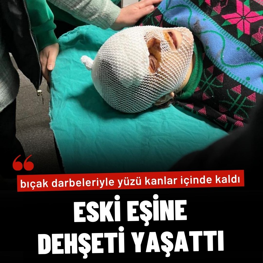 Barışma teklifini reddeden dini nikahlı eski eşine dehşeti yaşattı