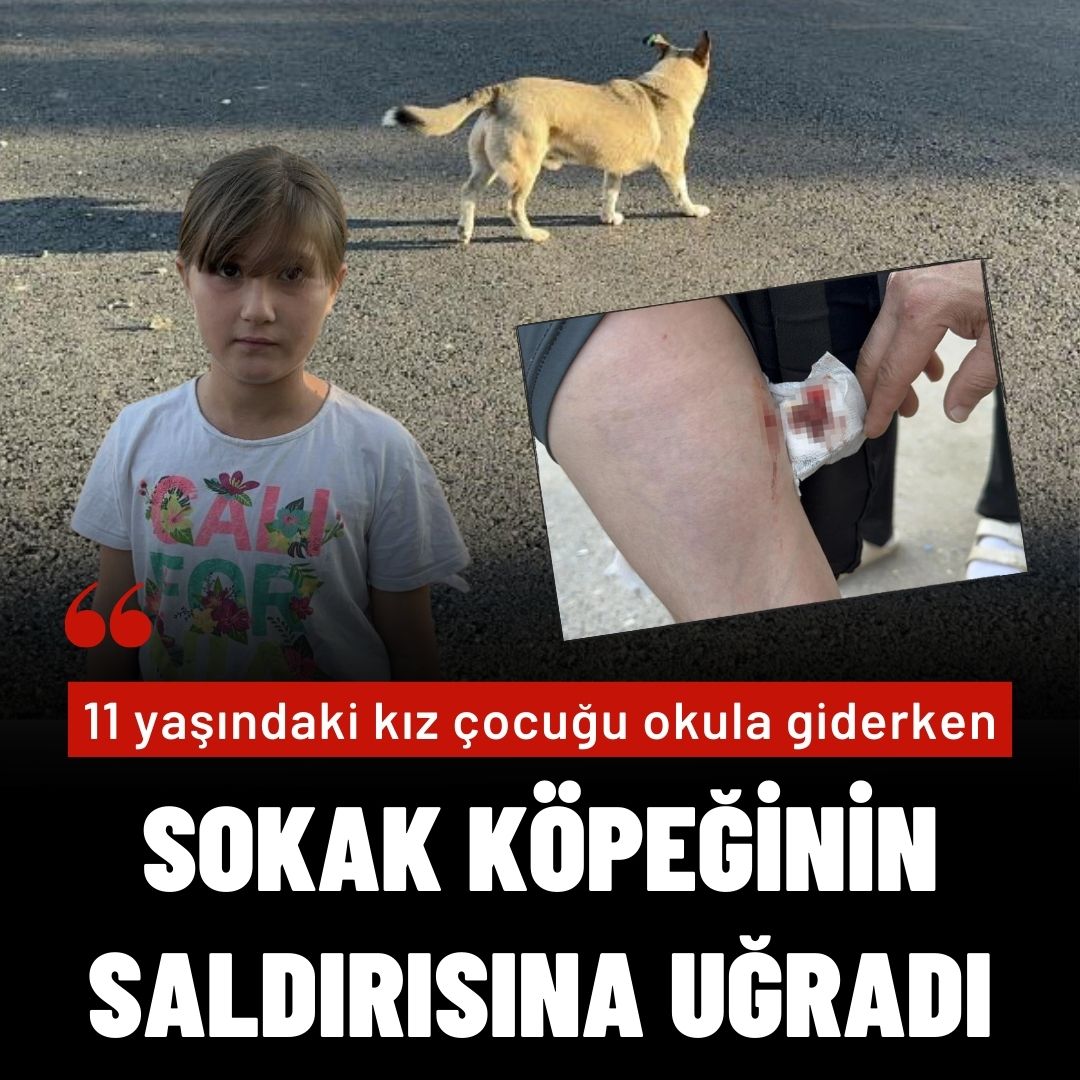 Okula giderken sokak köpeğinin saldırısına uğradı